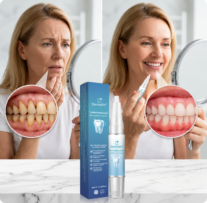 Dentalift™ | Gendanner tilbagetrækket tandkød og gør gule tænder hvidere på kun 3 dage
