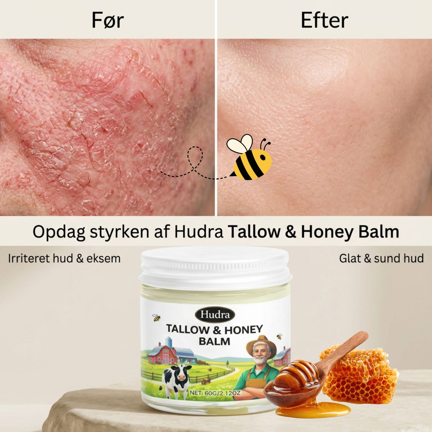 Hudra™ | Hudreparerende balsam